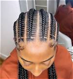 Are Feed-in Braids Actually Safe for Thin Hair? What Stylists Reveal