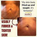 Besque Magic Body Oil Before and After: Real Results on Skin Texture and Glow