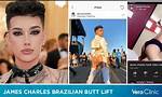 Did James Charles Really Get a Bbl? the Truth Behind the Viral Coachella Rumors