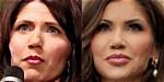 Did Kristi Noem Get Plastic Surgery? Fact-Checking Rumors, Expert Claims, and Reality