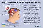 Inside the Adhd Brain: Clinical Proof of How Intuniv Strengthens Executive Focus