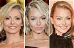 Kelly Ripa Before and After: the Photos Reigniting Plastic Surgery Speculation