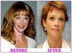 Lauren Holly Plastic Surgery Faq: Answers to Fans' Most Searched Questions