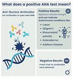 Positive Ana Test Meaning: Why a Pos Ana Result Does Not Always Mean Lupus