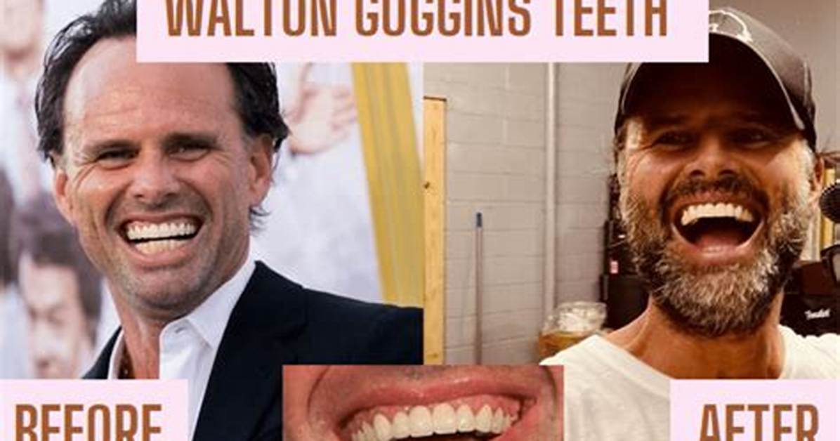 The Brutal Truth Behind Walton Goggins' Teeth: How He Lost Them Twice