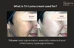 Tri-Luma Cream Before and After: Clinical Results on Stubborn Melasma