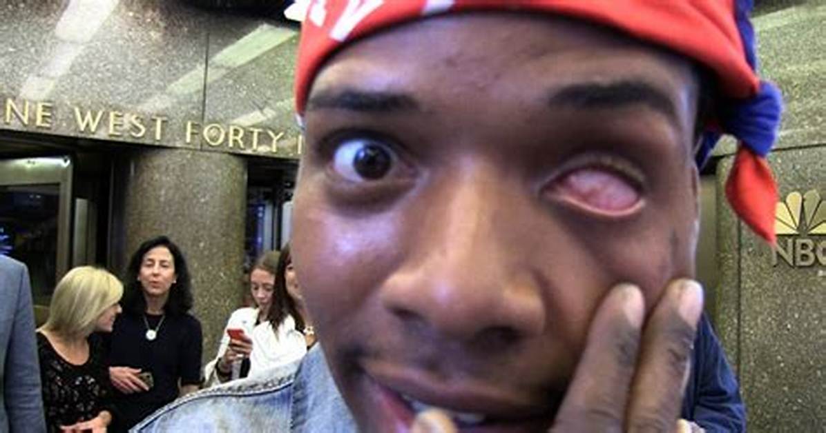 What Happened to Fetty Wap’s Eye? Everything to Know About His Condition