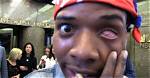 What Happened to Fetty Wap’s Eye? Everything to Know About His Condition