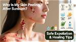 Your Skin Is Peeling After Sunburn: Safe Treatments and What to Avoid